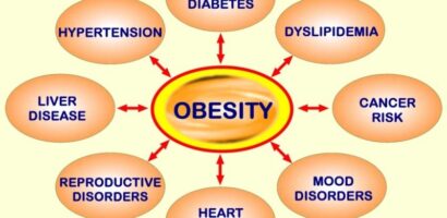 Is Obesity a Disease?